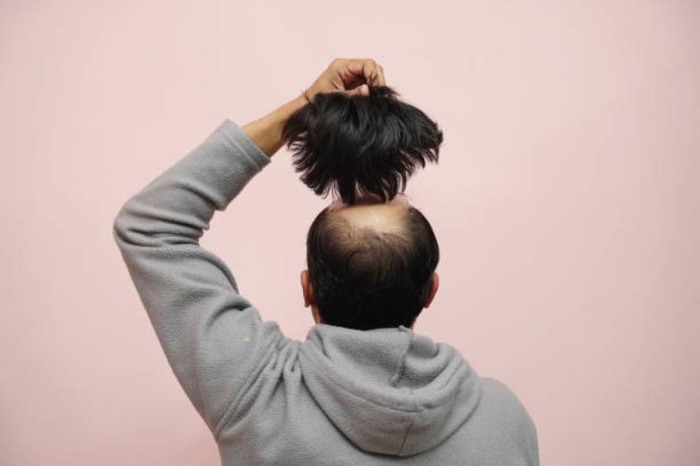 مميزات وصلات الشعر الطبيعية للرجال