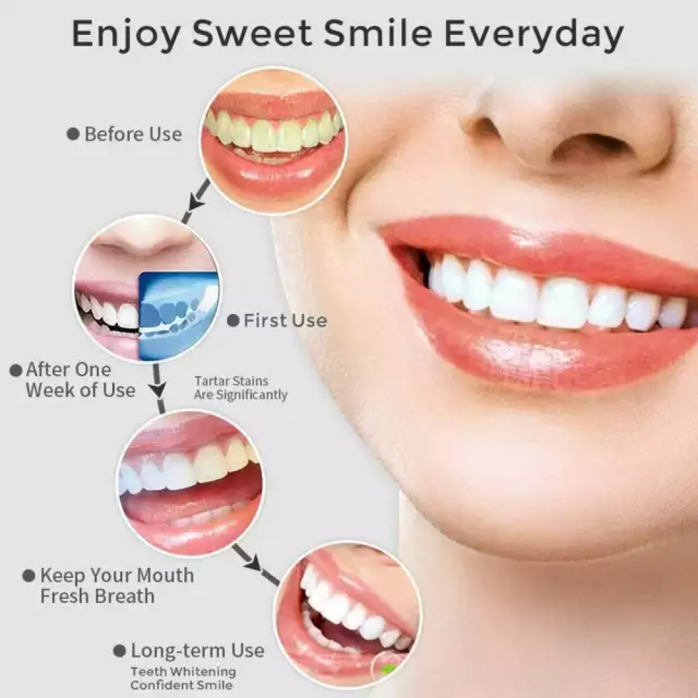 Ways to clean dental tartar
