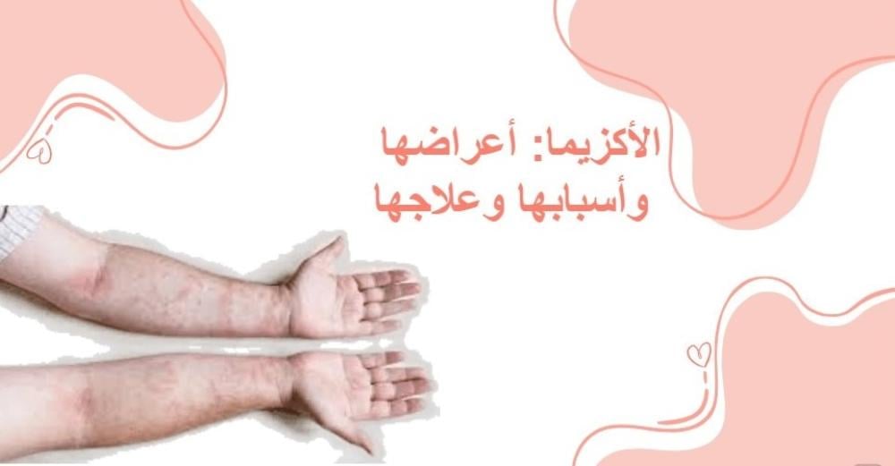 الأكزيما: ماهي؟ وماهي أعراضها؟ وأسبابها؟ وعلاجها؟