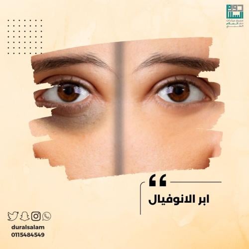 ابر الانوفيال