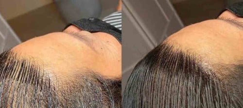 تغطية مقدمة الرأس