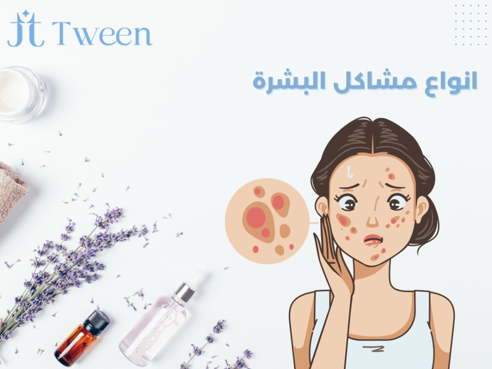 انواع مشاكل البشرة