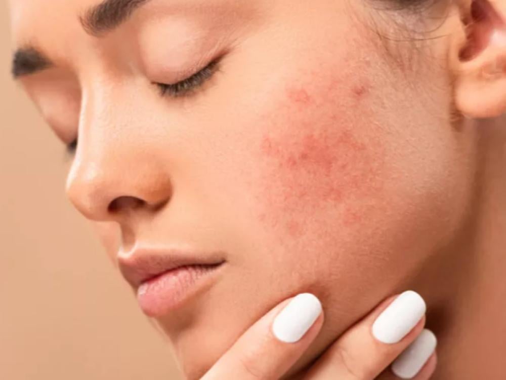 كيفية تقليل الالتهابات في الجسم للحصول على بشرة صافية ومشرقة