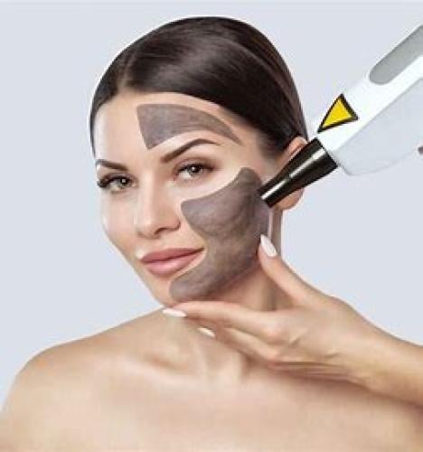 جلسة ليزر كربوني