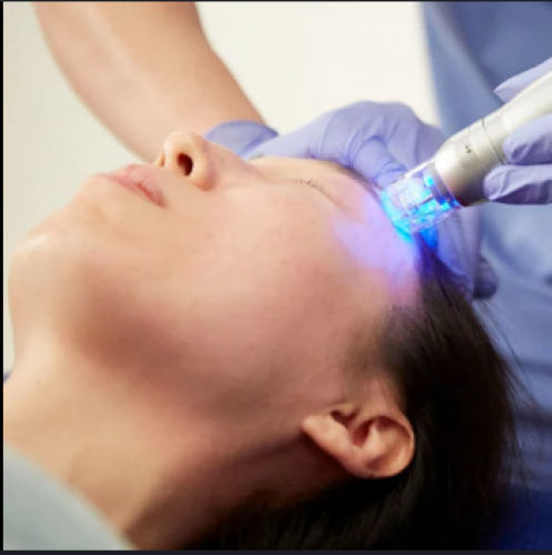 جلسة سكارليت + اكسوزوم أو السالمون