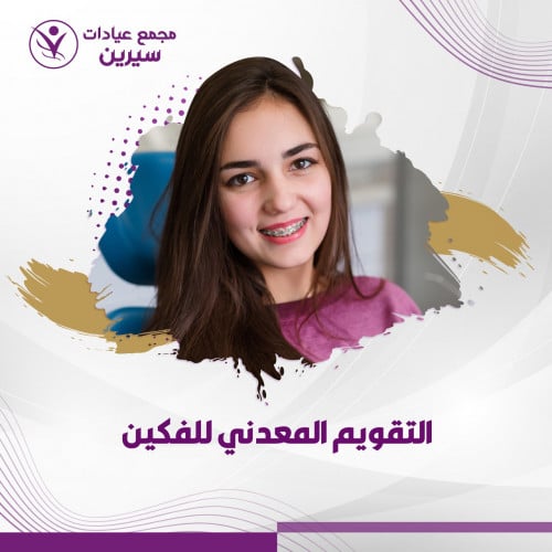 الدفعة الأولي للتقويم المعدني للفكين ( أقساط )