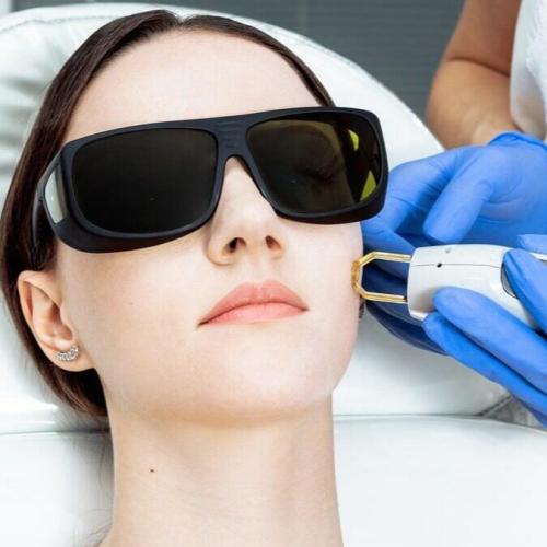 4 جلسات ليزر منطقة الوجه - نساء