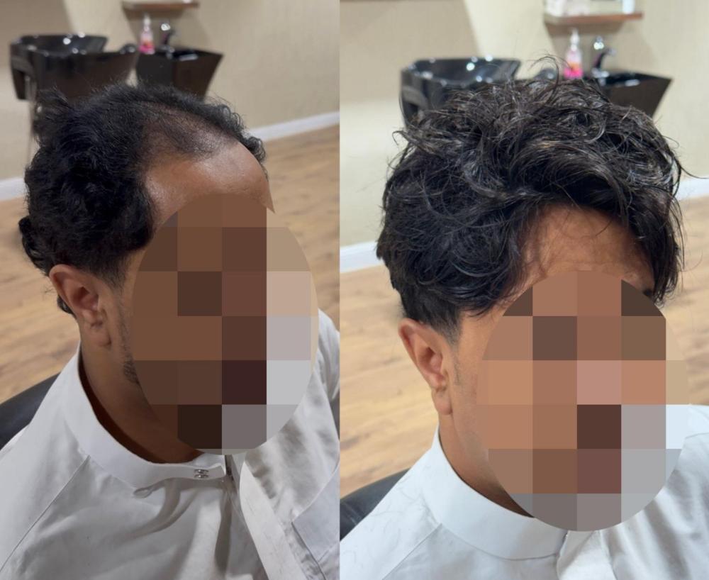 باروكة شعر طبيعي للرجال بالرياض والسعودية استعد ثقتك بمظهر طبيعي 100%