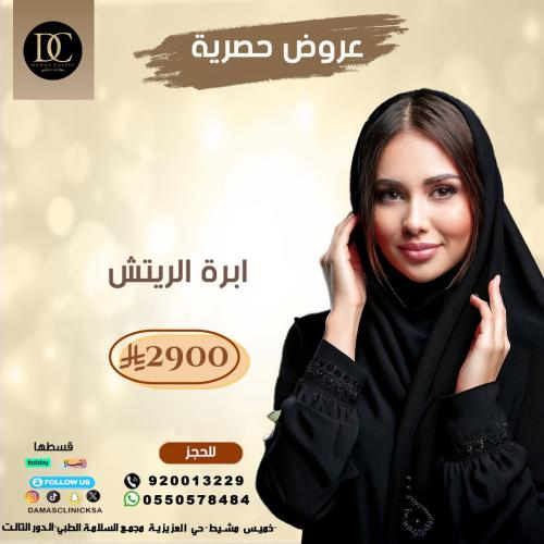 ابرة الريتش