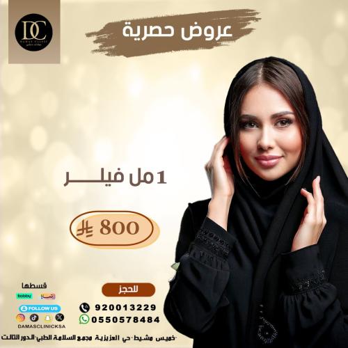 1 ملى فيلر