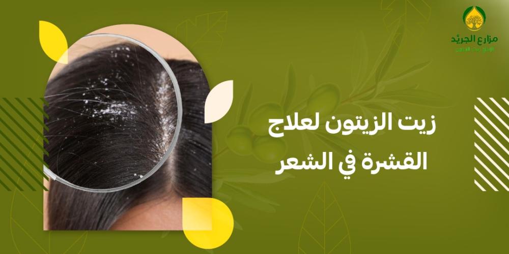 زيت الزيتون السحري: الحل الأمثل لعلاج القشرة في الشعر ! زيت الزيتون السحري: الحل الأمثل لعلاج القشرة في الشعر !