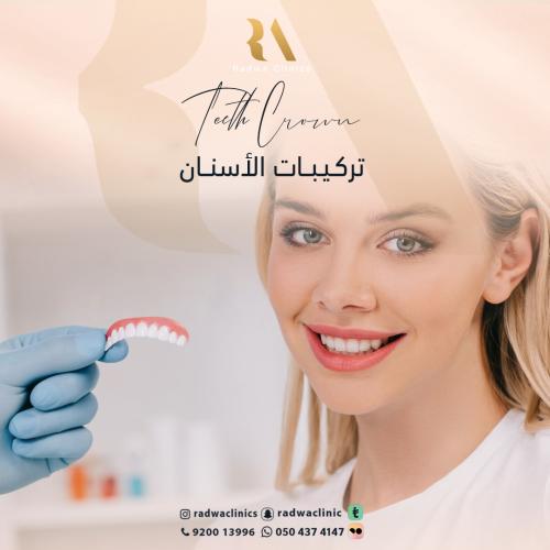 تركيبات الاسنان تبدا من
