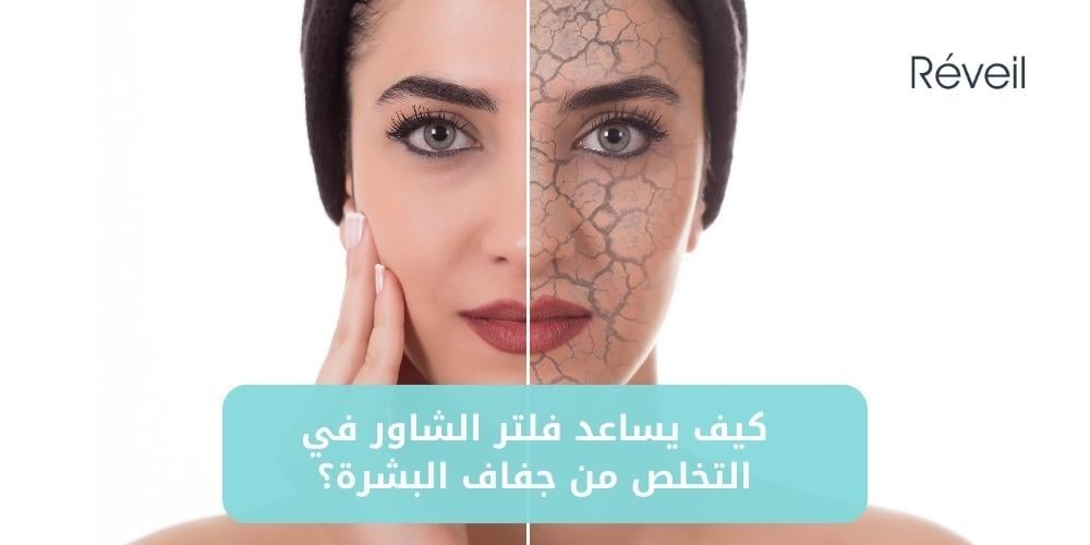 كيف يساعد فلتر الشاور في التخلص من جفاف البشرة؟