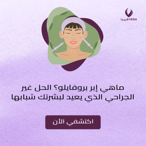 ماهي ابر بروفايلو