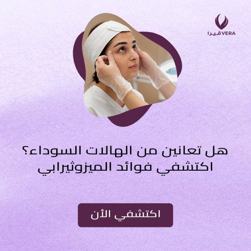 فوائد الميزوثيرابي للهالات السوداء