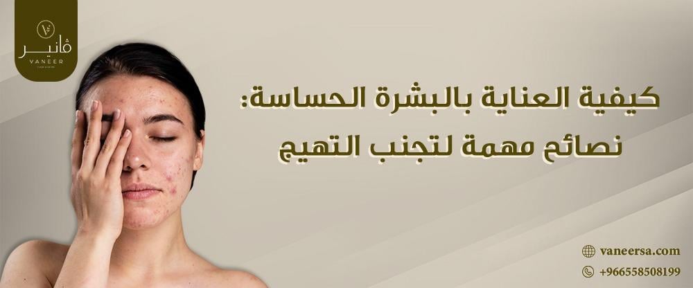 كيفية العناية بالبشرة الحساسة: نصائح مهمة لتجنب التهيج