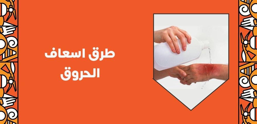 طرق اسعاف الحروق