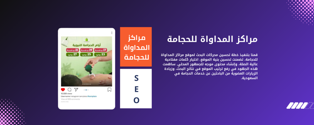 أفضل مركز حجامة في الرياض