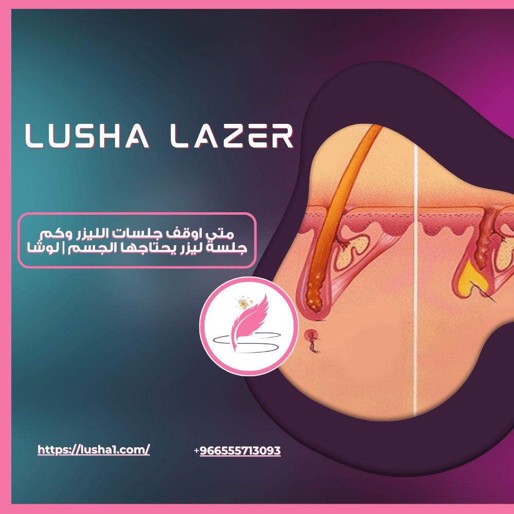 متى اوقف جلسات الليزر