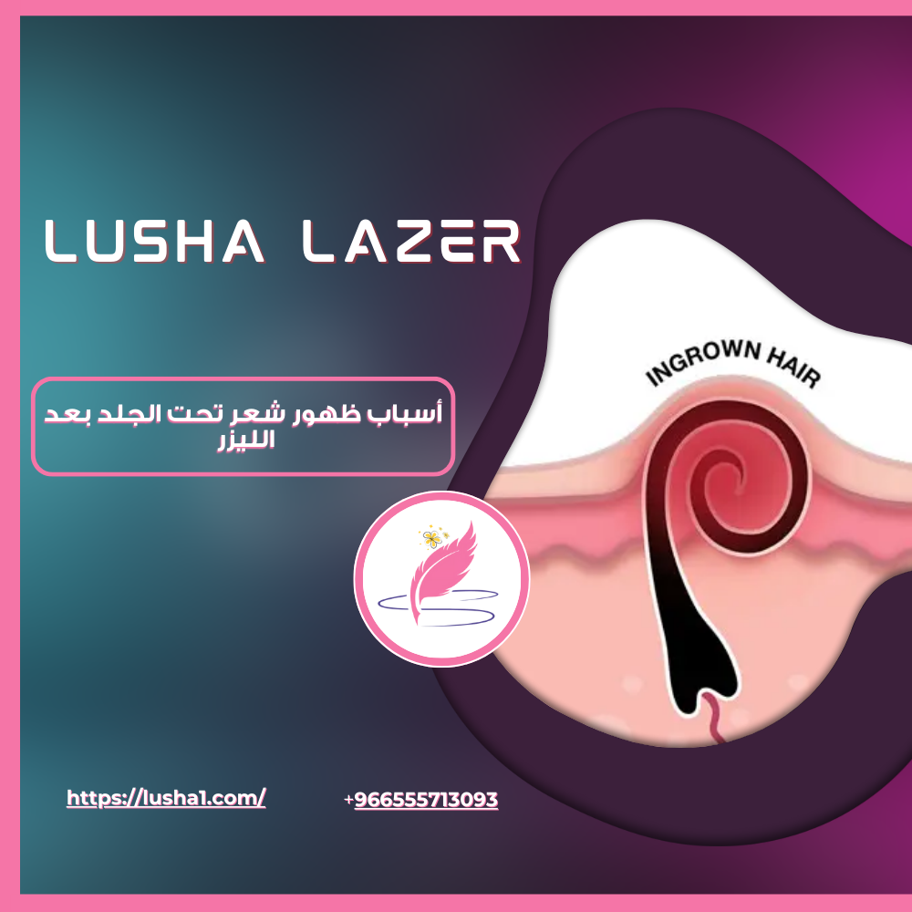 أسباب ظهور شعر تحت الجلد بعد الليزر