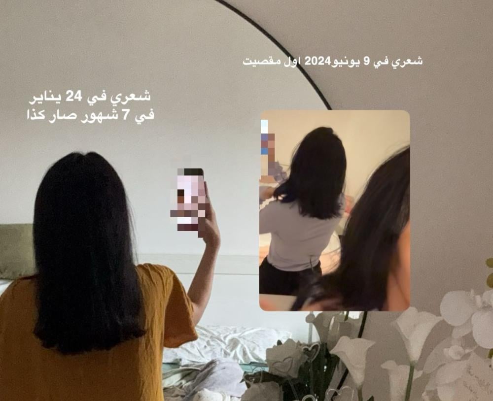 تعرفي على الحل الطبيعي لتساقط الشعر واستعيدي جمال شعركِ