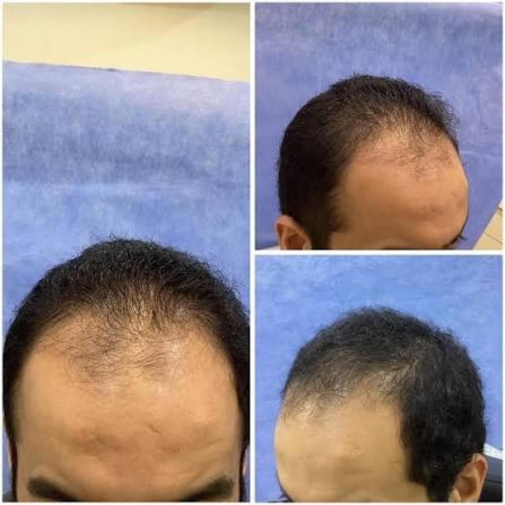 أفضل الزيوت الطبيعية للاستخدام اليومي للعناية بالشعر