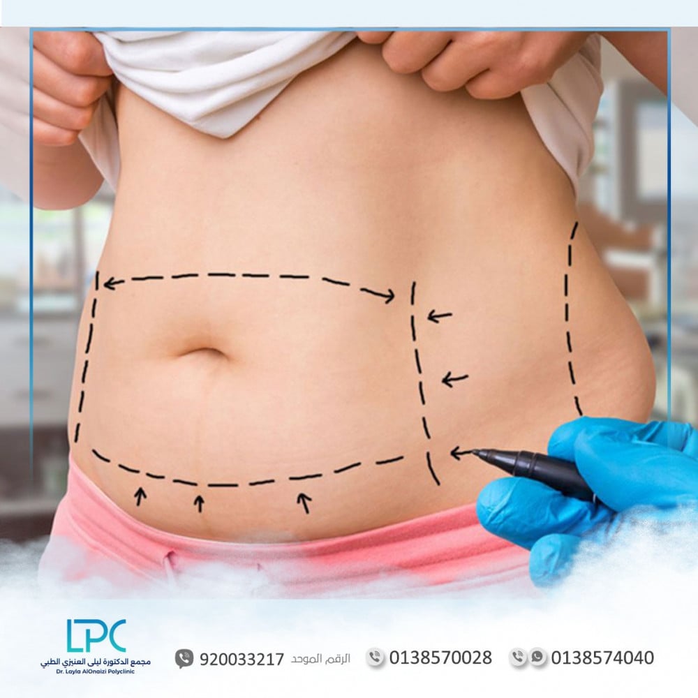 Slimming Treatment with Mesotherapy – Dr. Ayfer Aydın