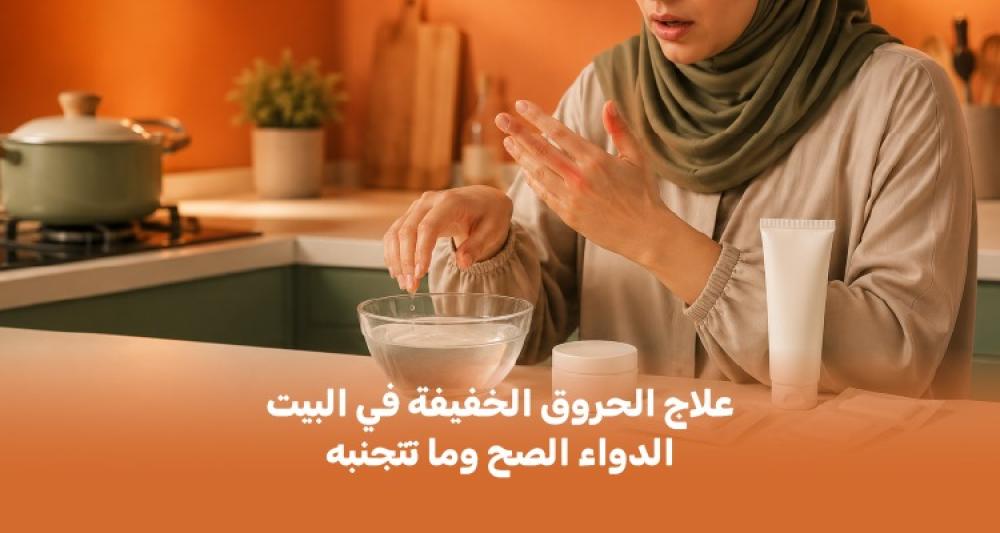 علاج الحروق الخفيفة في البيت: الدواء الصح وما تتجنبه