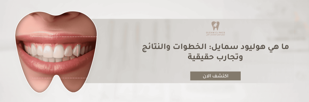 ما هي هوليود سمايل