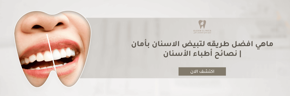 ماهي افضل طريقه لتبيض الاسنان