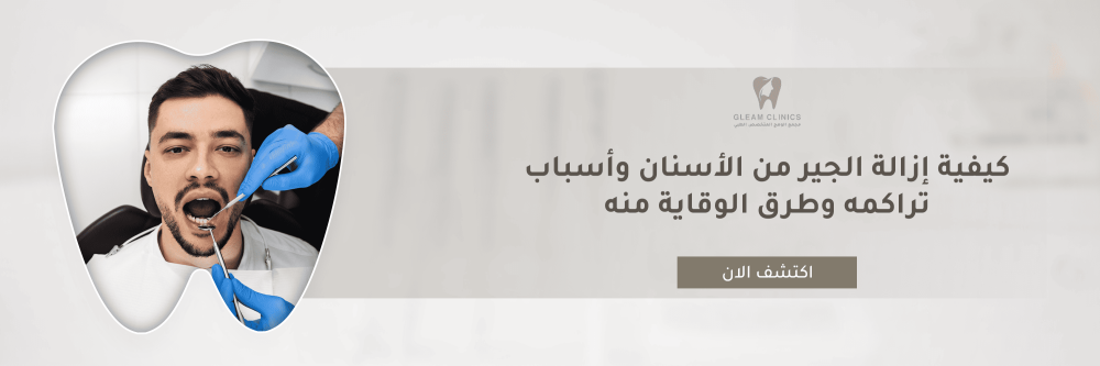 كيفية ازالة الجير من الاسنان