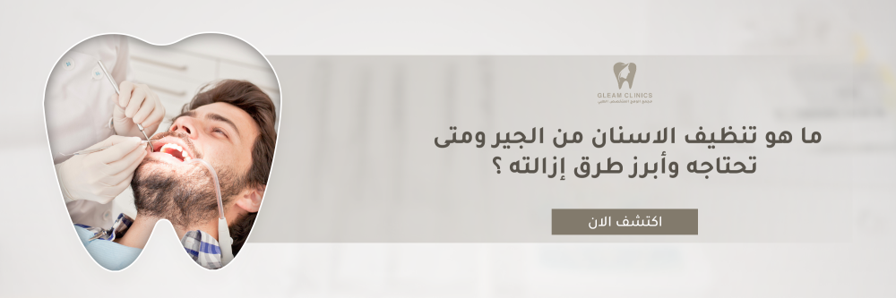 ما هو تنظيف الاسنان من الجير ومتى تحتاجه وأبرز طرق إزالته ؟