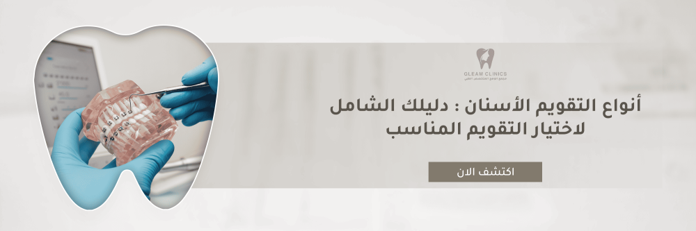 أنواع التقويم الأسنان