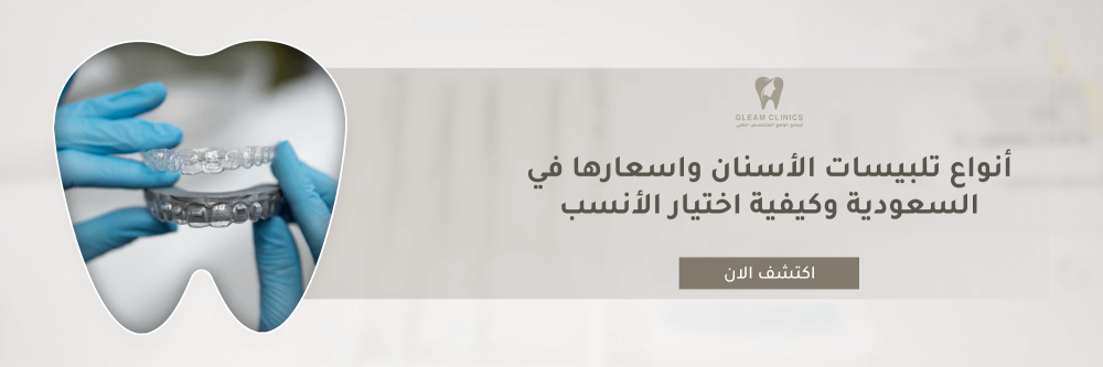 أنواع تلبيسات الأسنان واسعارها في السعودية وكيفية اختيار الأنسب