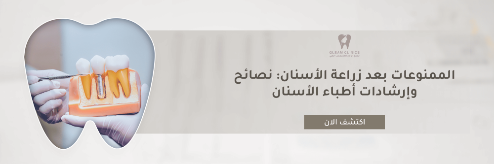 الممنوعات بعد زراعة الأسنان
