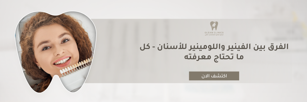 الفرق بين الفينير واللومينير للأسنان - كل ما تحتاج معرفته