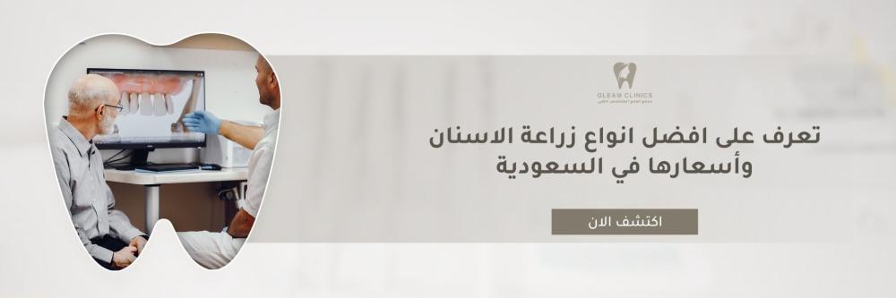 افضل انواع زراعة الاسنان