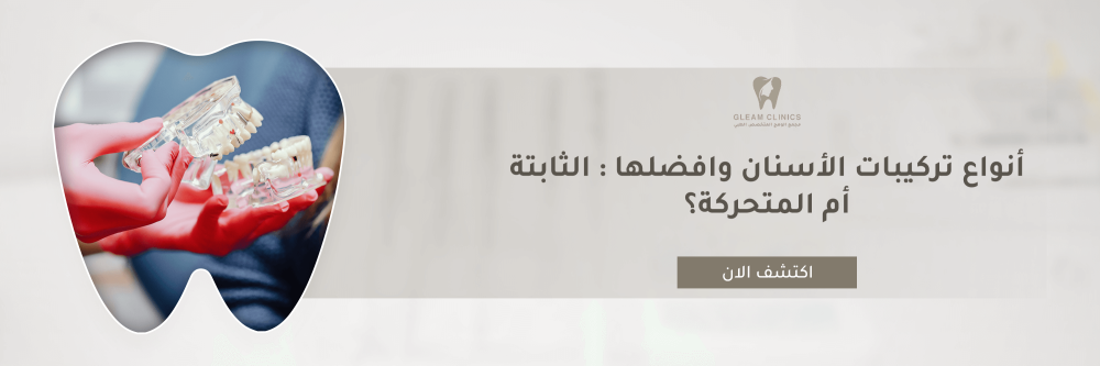 أنواع تركيبات الأسنان وافضلها : الثابتة أم المتحركة؟