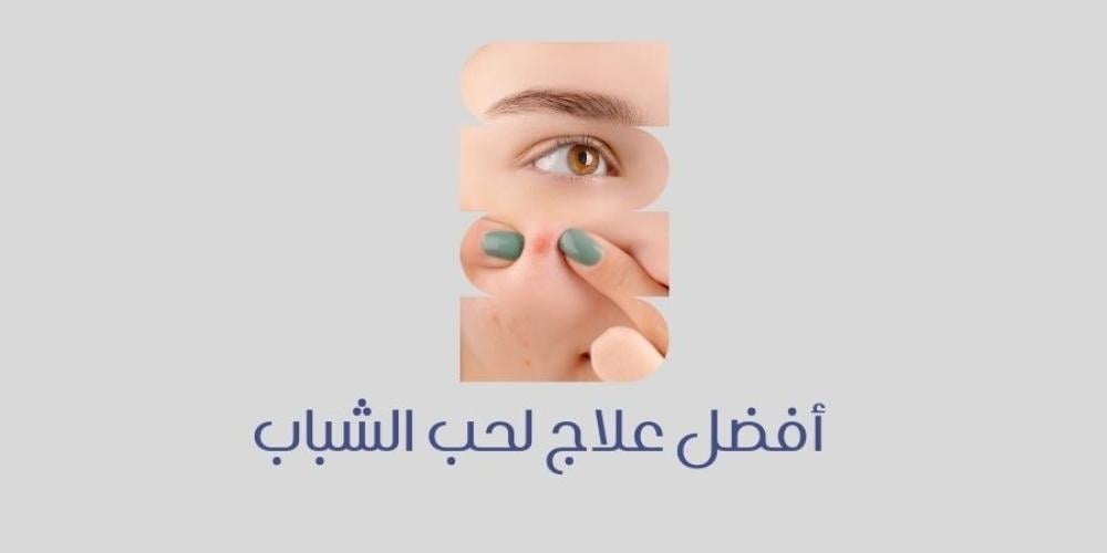 أفضل علاج لحب الشباب