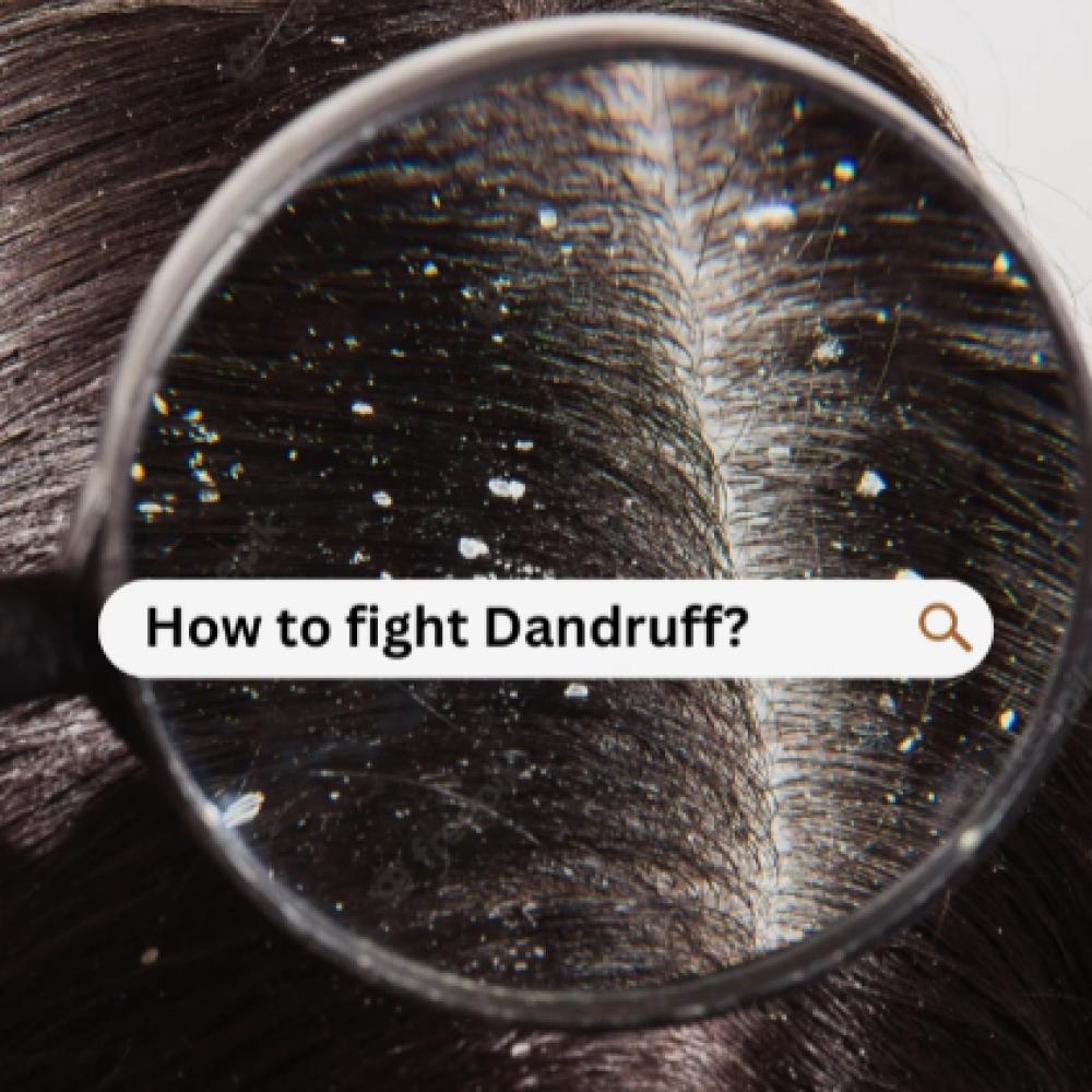How to Get Rid of Dandruff Effectively