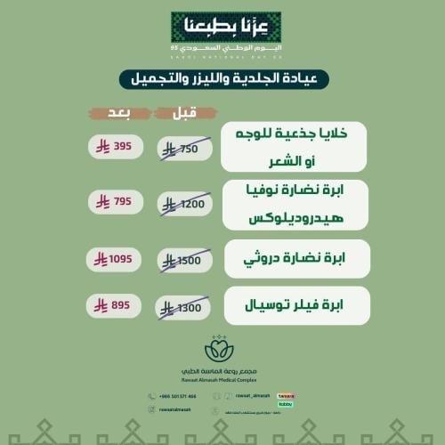 ابرة فيلر توسيال