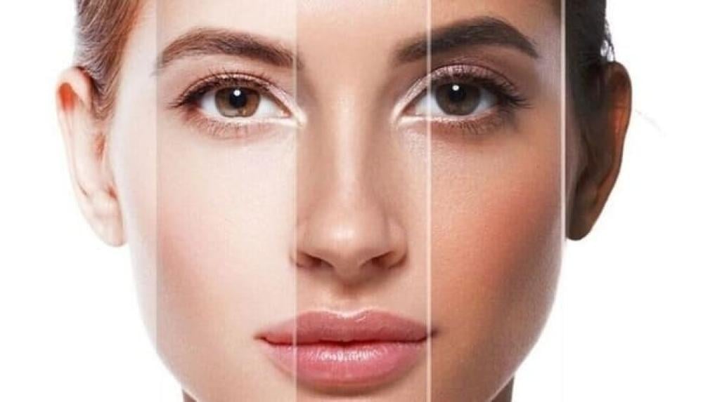 البشرة المختلطة: كيفية فهمها والعناية بها بدقة وفعالية  2024