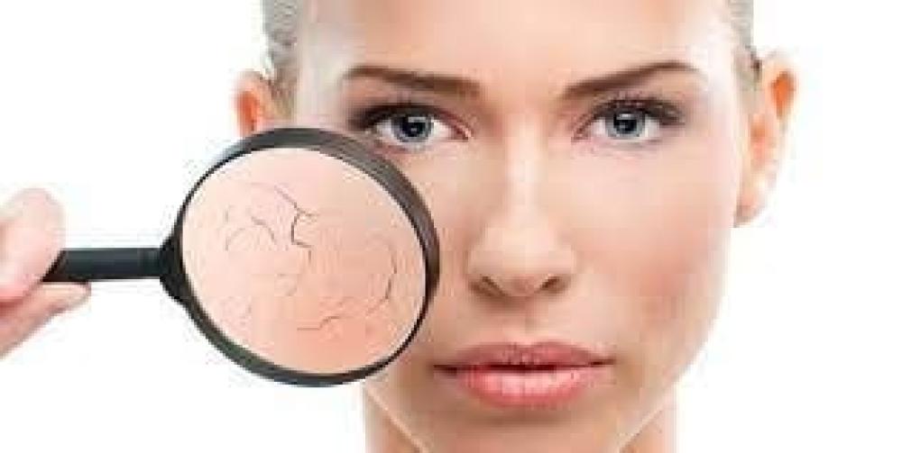 حلول مبتكرة لجفاف البشرة: دليل شامل للعناية والعلاج 2024