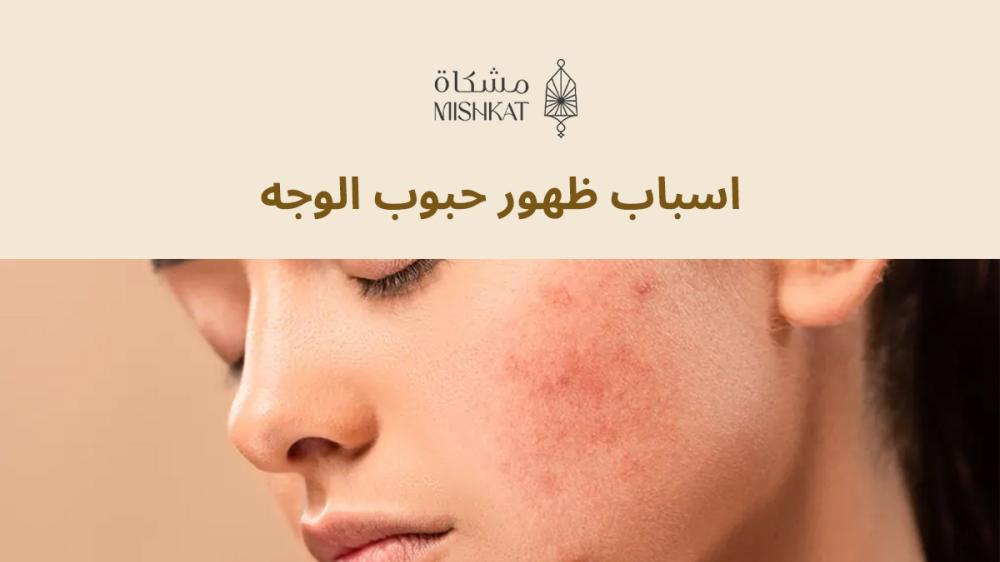 اسباب ظهور حبوب الوجه