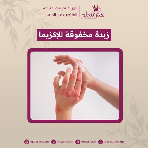زبدة الأكزيما