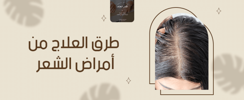 طرق العلاج من أمراض الشعر