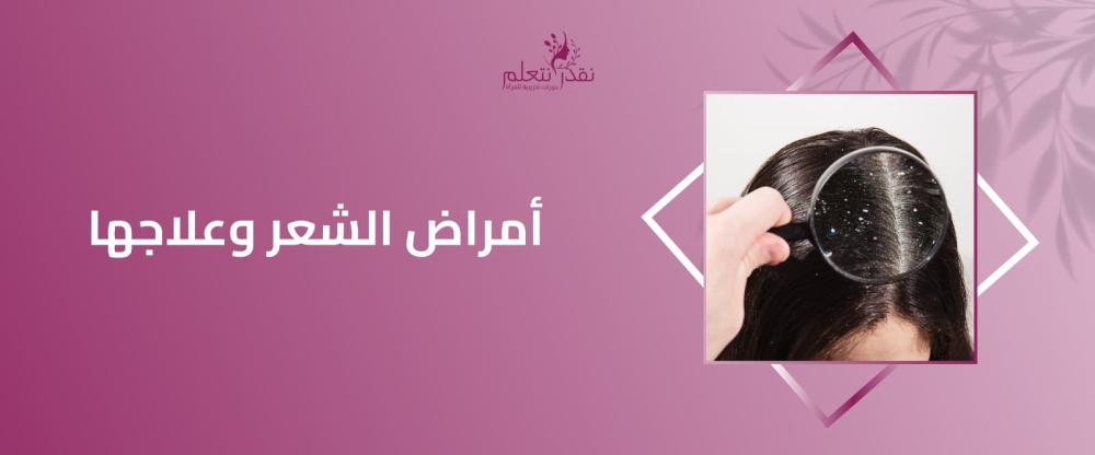 أمراض الشعر وعلاجها
