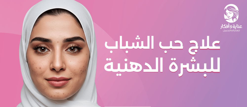 علاج حب الشباب للبشرة الدهنية