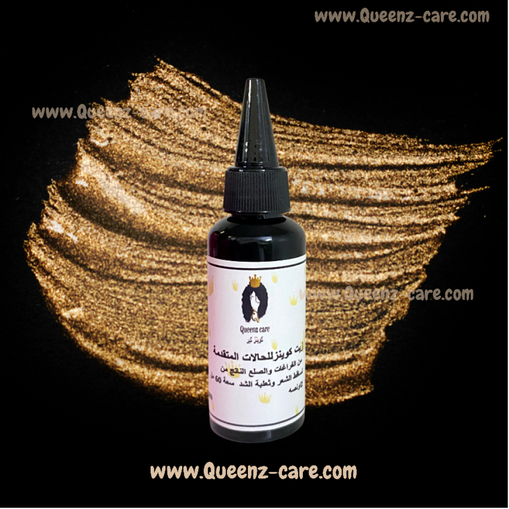 Queens Oil for Advanced Cases of Voids and Baldness Due to Hair Loss and  Traction Alopecia 60ml 2oz - كوينز كير