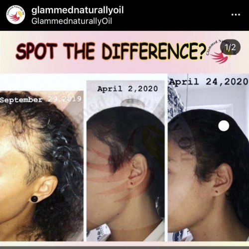زيت التألق حجم صغير لتحفيز وتطويل الشعر  والقضاء ع الفراغات حجم 60 مل  2 اونصه من  غلامد ناتشورالي اويل glammednaturallyoil